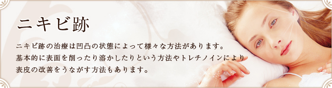 ニキビ跡